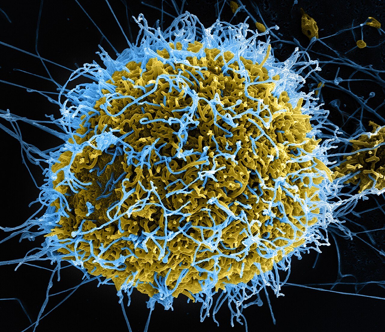 Colourised scanning electron micrograph of Ebola virus particles, in blue, budding from an infected cell, in yellow